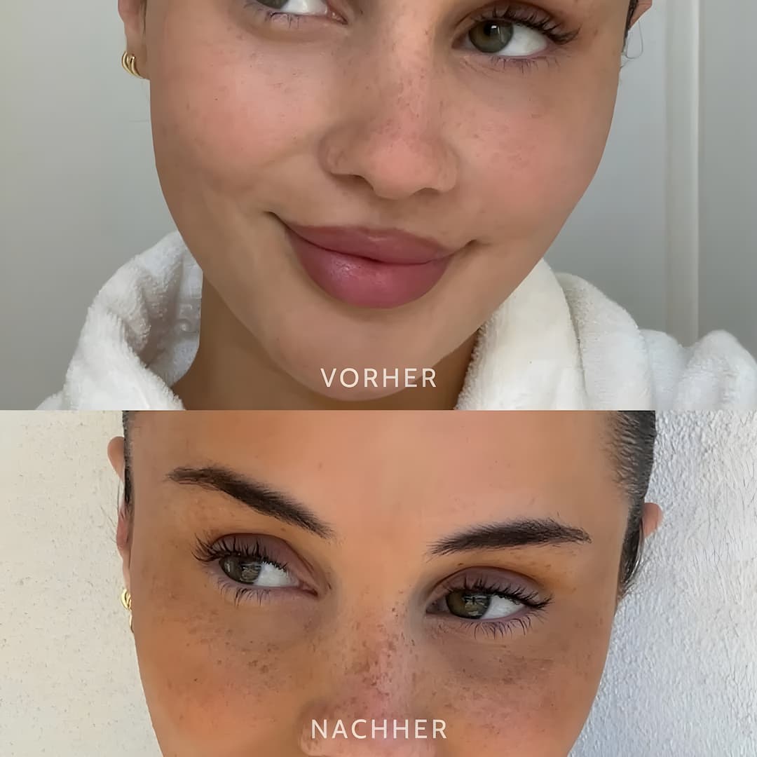 FreckleStamp