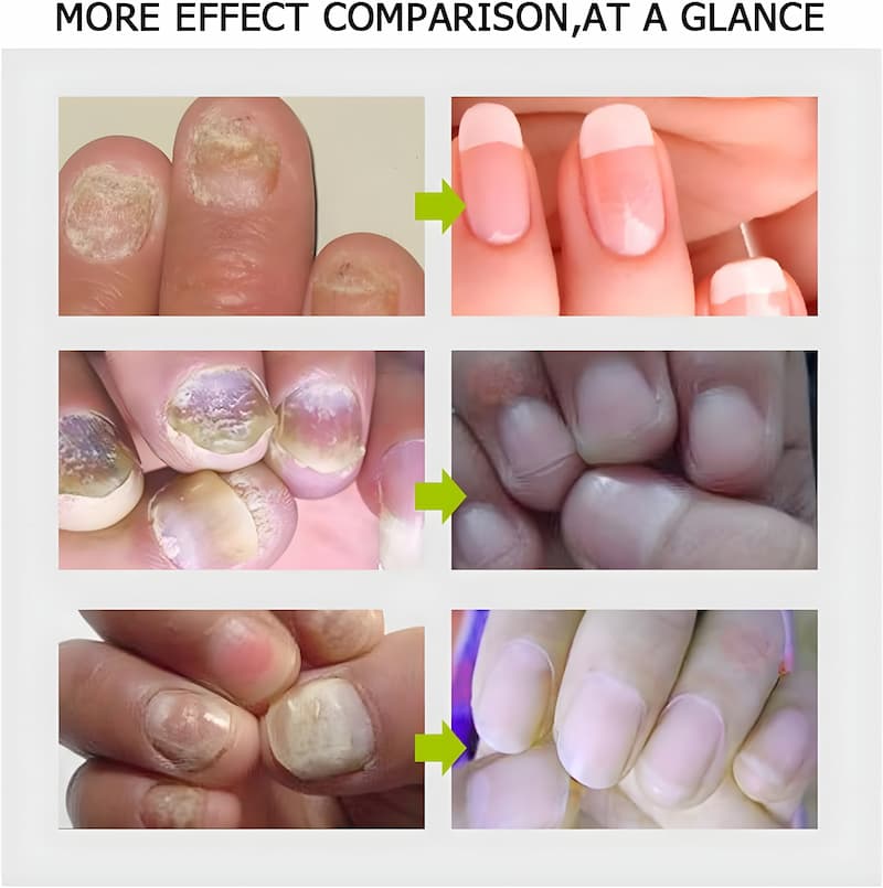 Efero - Gesunde & schöne Nägel