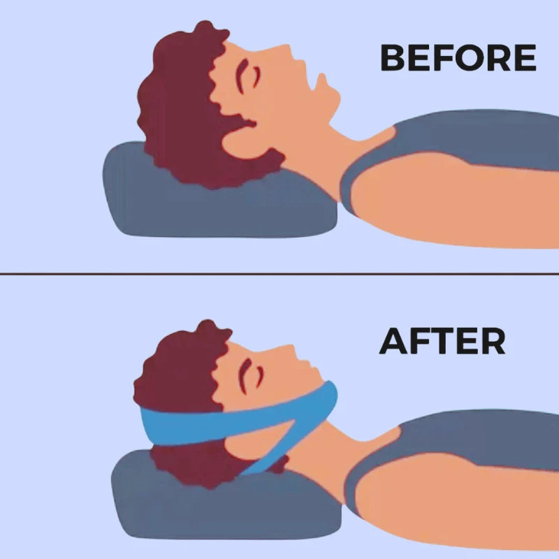 SnoringBelt - Anti-Schnarch-Kinnriemen