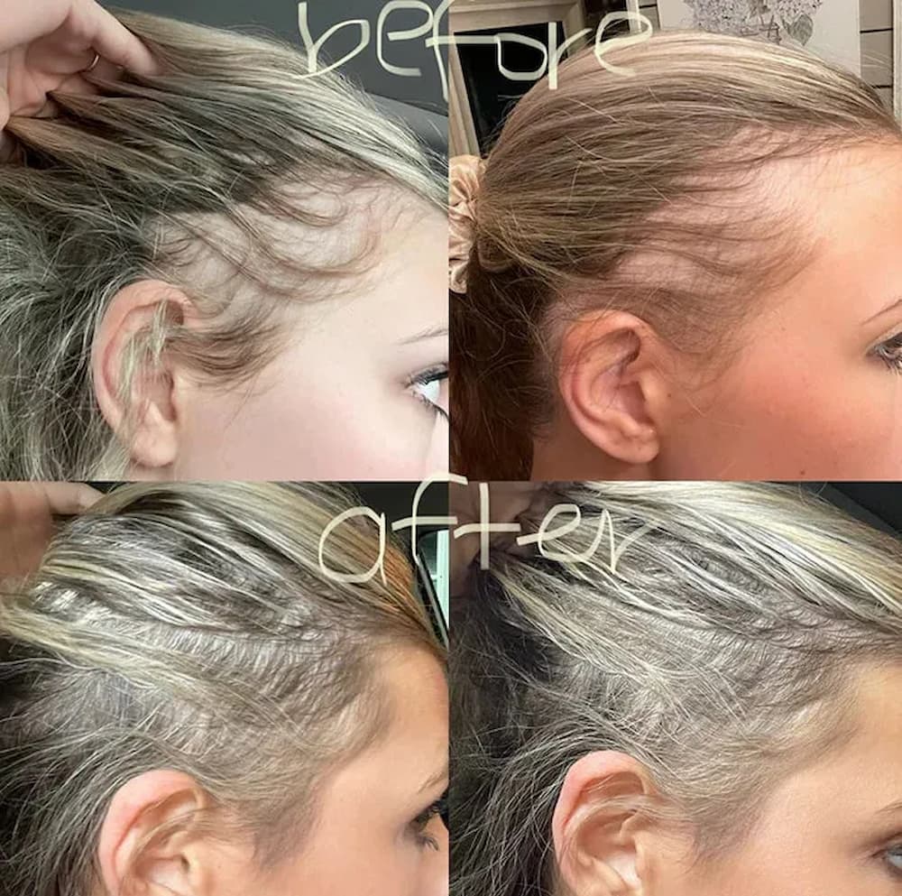 Vanura - Rotlichtbürste mit Tiefenstimulation der Kopfhaut