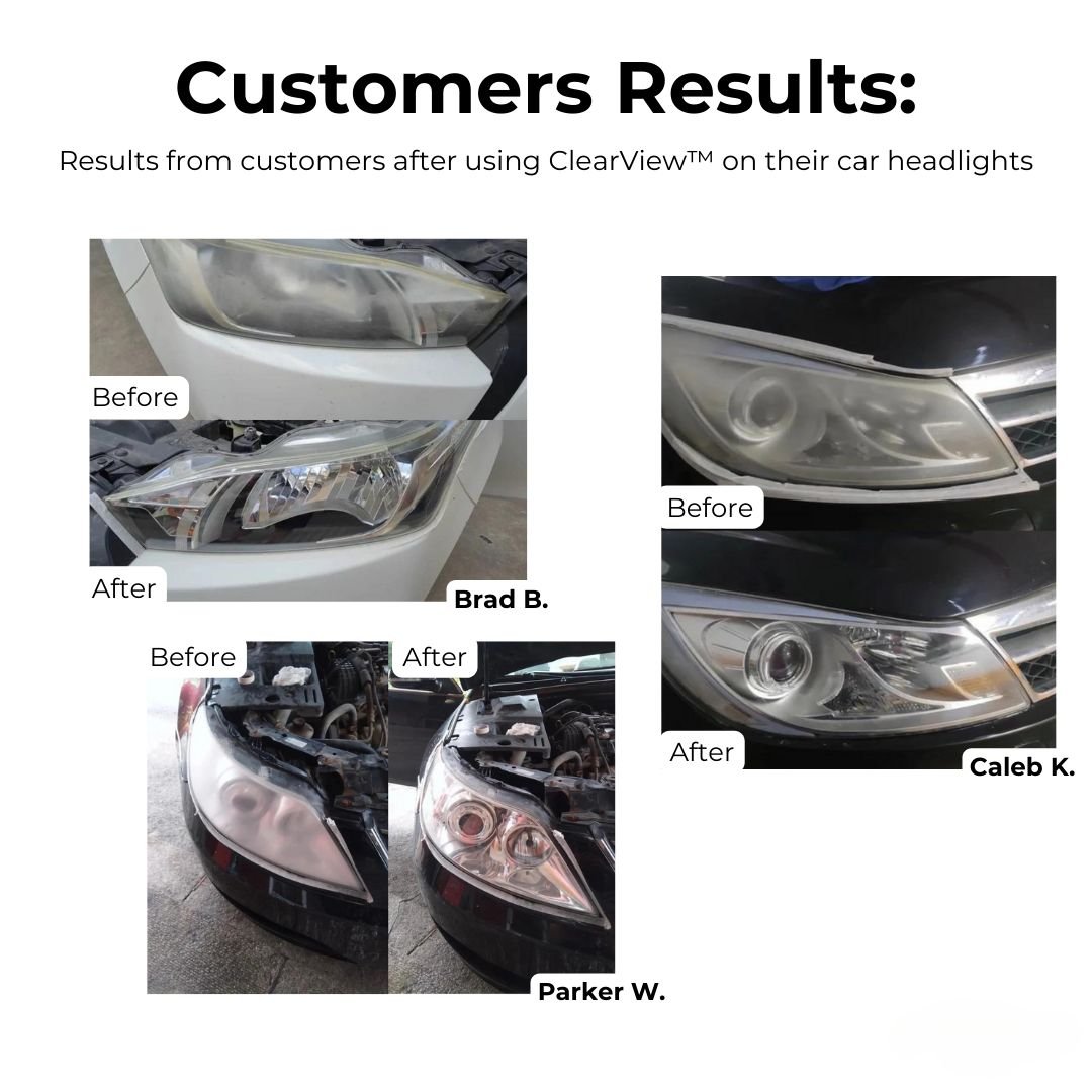 HeadlightRestore - Frest