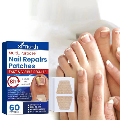 Nail Patches -  Pflaster zur Behandlung von Nagelpilz [60 Stück]