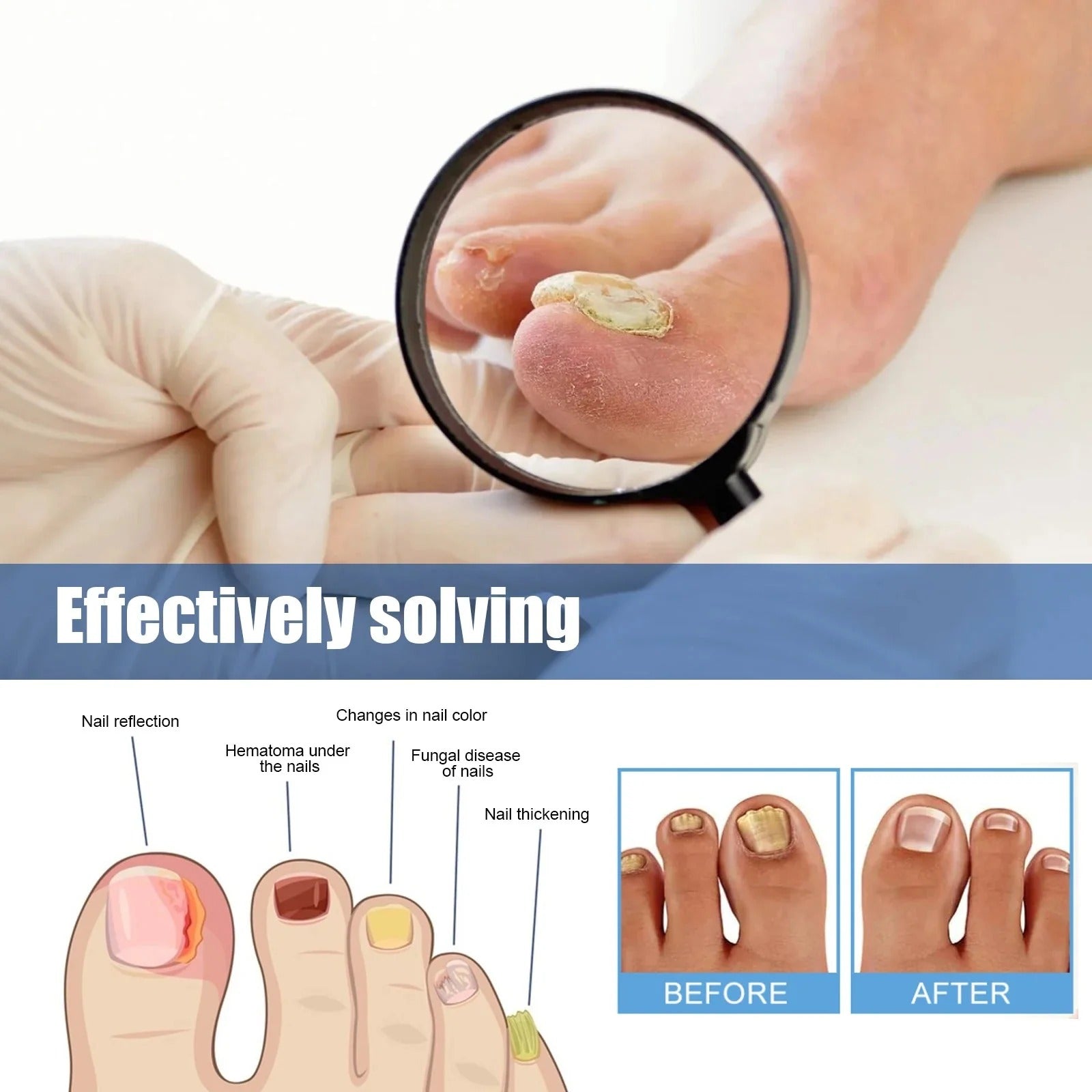 Nail Patches -  Pflaster zur Behandlung von Nagelpilz [60 Stück]