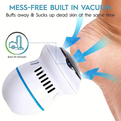 CalusGrinder