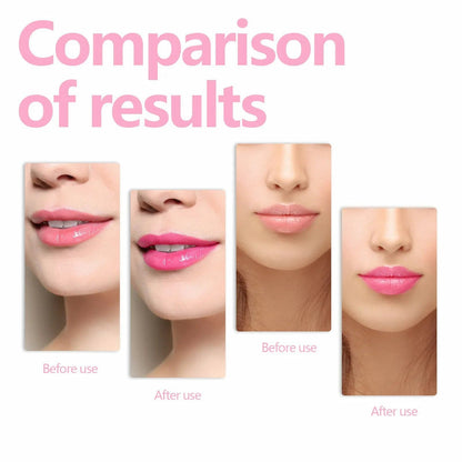 Loli Lips -  Entfessle deinen einzigartigen Glanz mit weichen, üppigen Lippen, die zum Küssen einladen