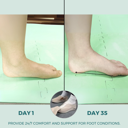 ComfySteps - Bequeme Schuhe für geschwollene Füße