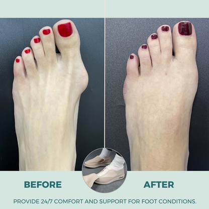 ComfySteps - Bequeme Schuhe für geschwollene Füße