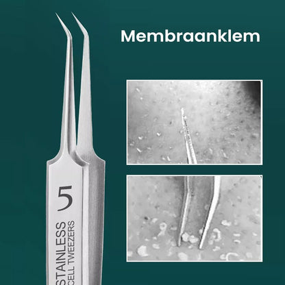 FineCet - Ultrafeine Pinzette zum Entfernen von Mitessern! - Frest